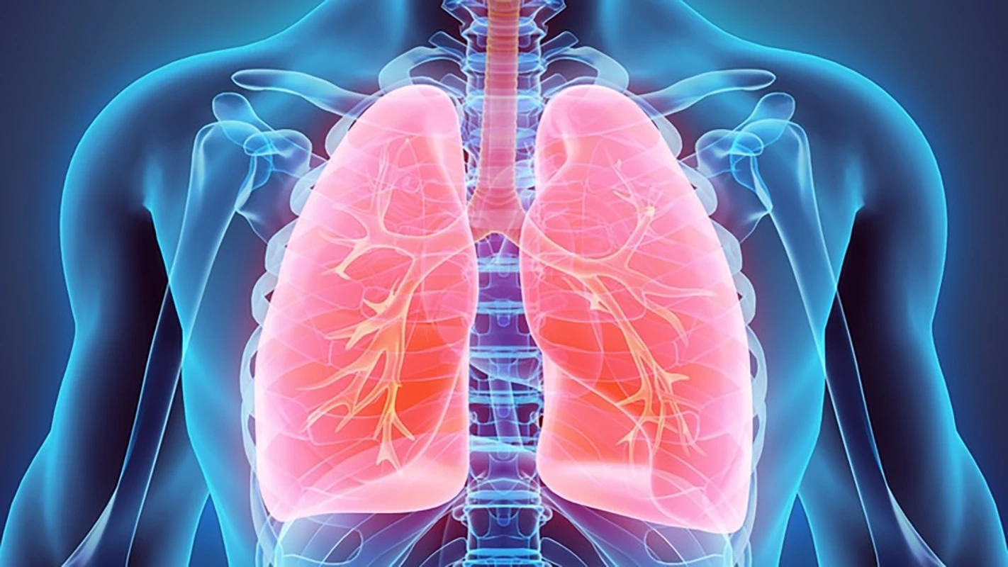 Hipertensión pulmonar